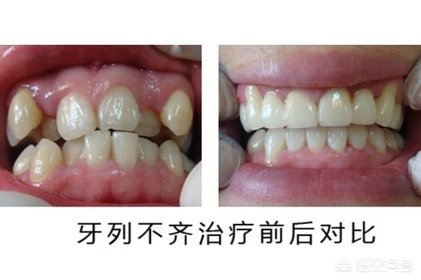 日土最新24小时牙医在线咨询方法分析(最方便真实的日土有没有24小时牙医方法)