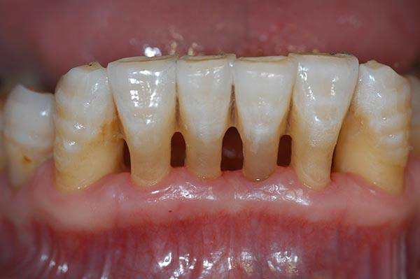 日土最新24小时牙医在线咨询方法分析(最方便真实的日土有没有24小时牙医方法)